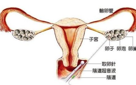 2026呼伦贝尔市最新男性陪产假有多少天？试管婴儿可以增加产假吗？