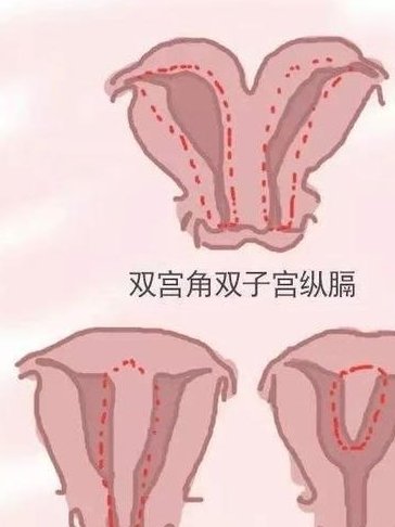 河南做第二代试管婴儿需要多少钱？有哪些需要注意的事项？