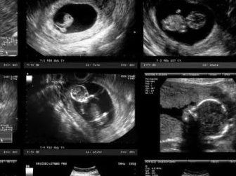 2026年马来西亚哪家医院比较好三代试管婴儿