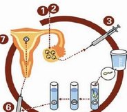 长沙试管婴儿医院成功率排名？附长沙试管婴儿医院明细！