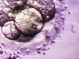 岳阳有哪些公立试管婴儿医院？如何选择适合自己的医院？