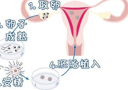 打完夜针会不会提前排出来